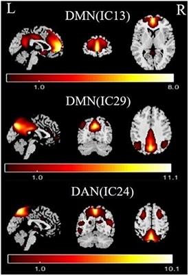 Dysfunctional Interaction Between the Dorsal Attention Network and the Default Mode Network in Patients With Type 2 Diabetes Mellitus